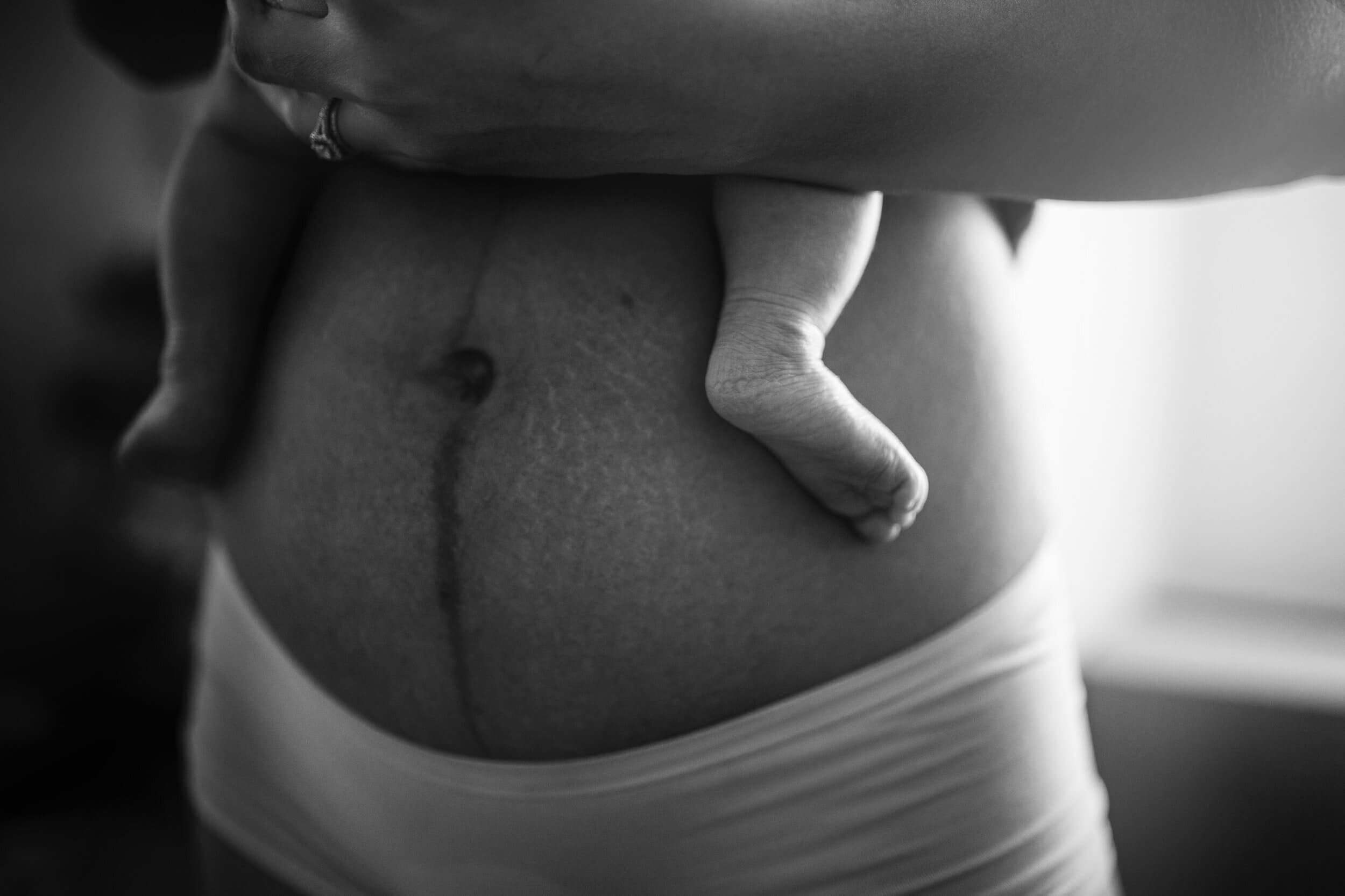 The belly of a postpartum mother, with the linea negra still visible, and baby's feet under her arms.